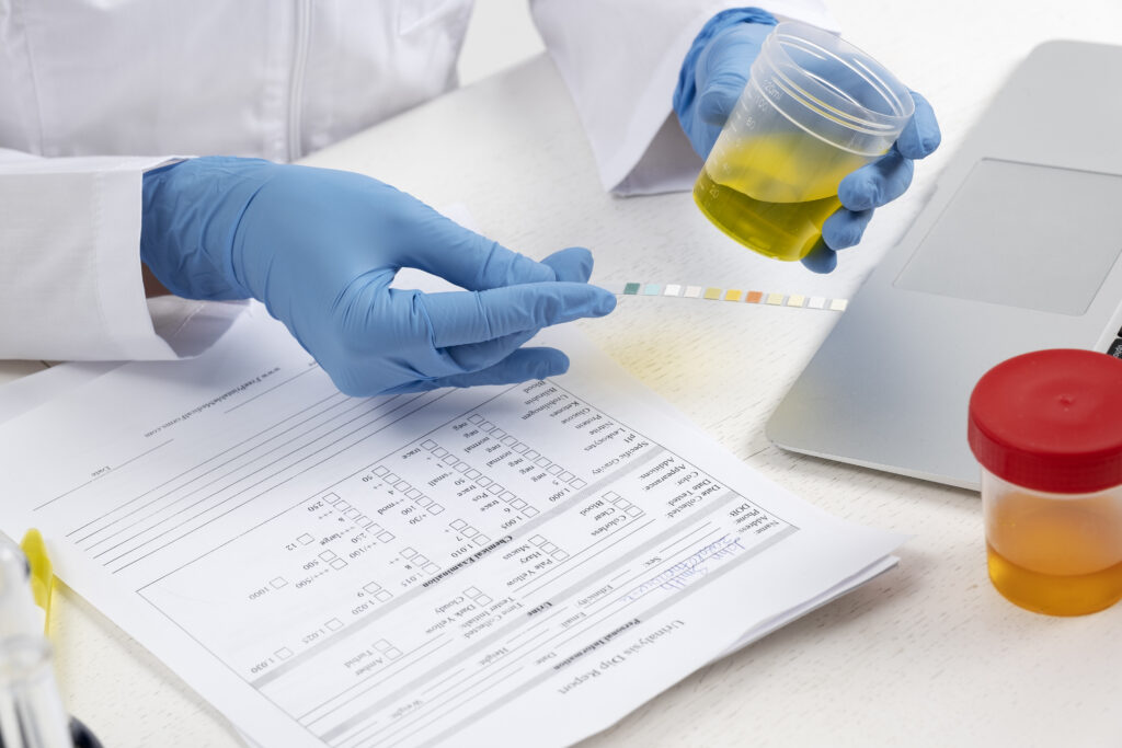 pus cells in urine